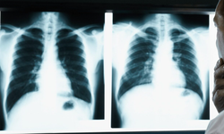 Kırşehir’den sağlık uyarısı: Bu belirtileri görmezden gelmeyin!