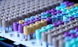 Evcil Kedilerden Kanser Tedavisine Işık