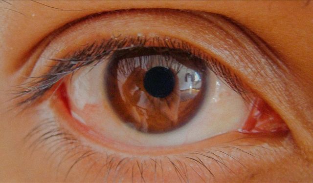 Sinsi Hastalık Körlüğe Götürüyor