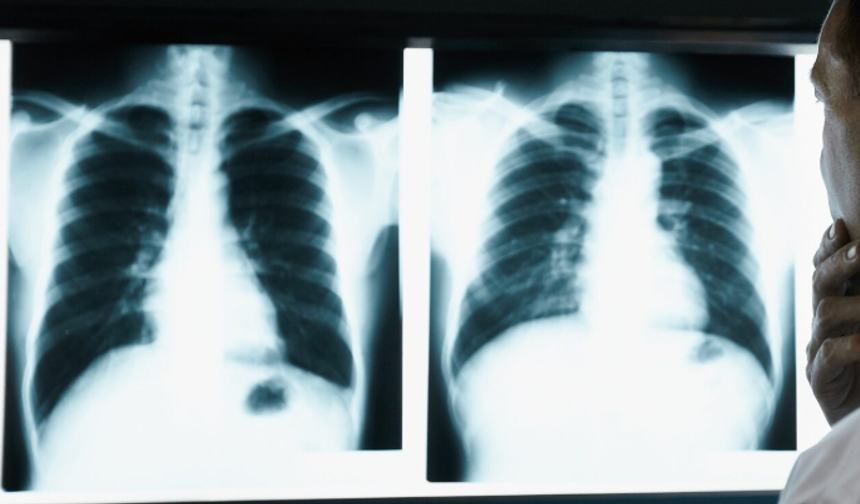 Kırşehir’den sağlık uyarısı: Bu belirtileri görmezden gelmeyin!