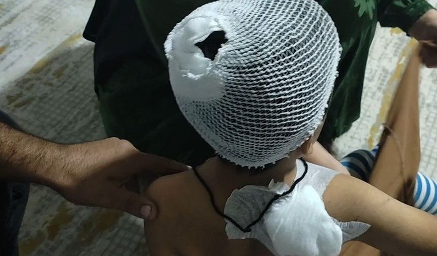 8 Yaşındaki Çocuğa Köpek Saldırısı! Annenin Feryadı Yürek Burktu